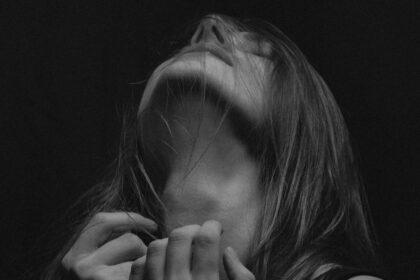 Photo trauma and the body