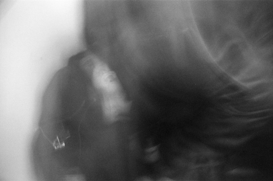 Photo depersonalization derealization disorder