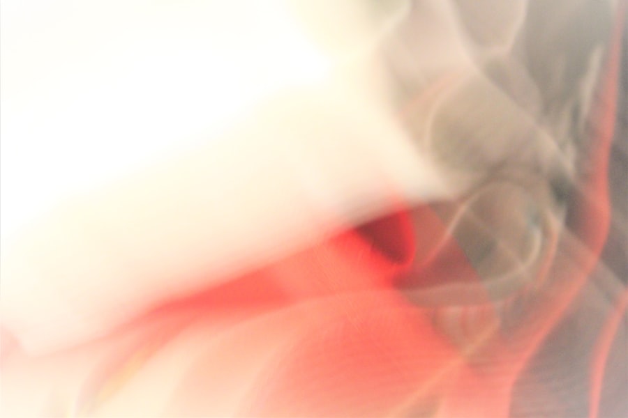 Photo depersonalization derealization disorder