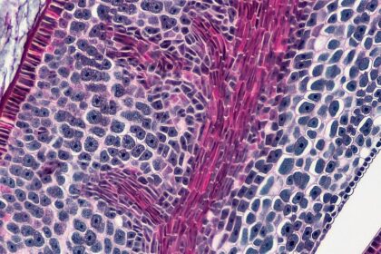 Photo Suprachiasmatic Nucleus