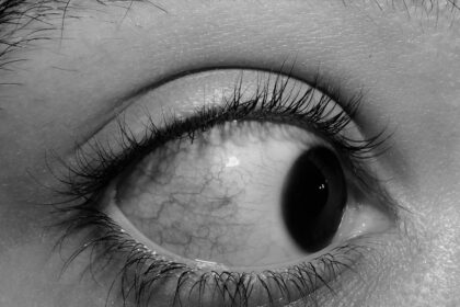 Photo Blind awareness syndrome