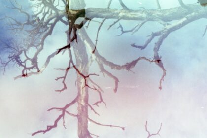 Photo stabilize nervous system