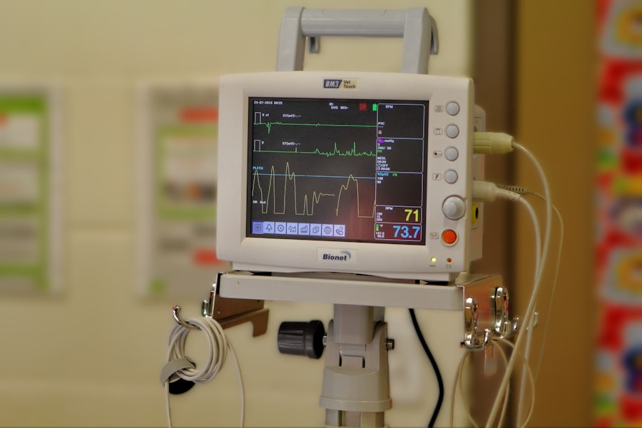 vestibular calibration