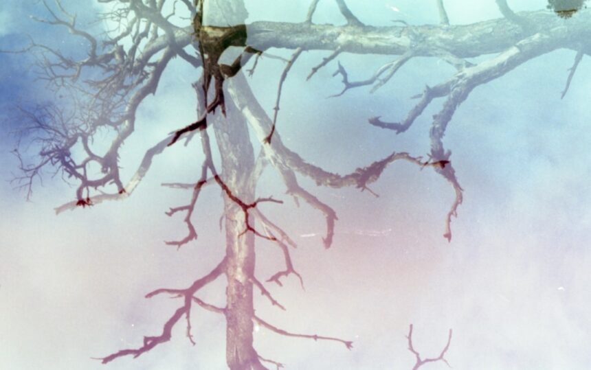 Photo neuroplasticity