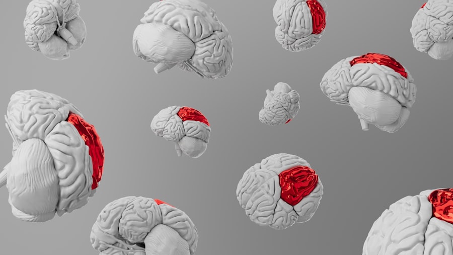 Photo amygdala hijack