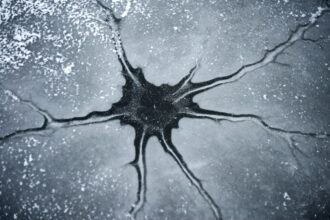 Photo nervous system relapse