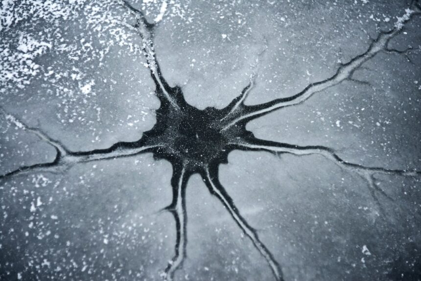 Photo nervous system relapse