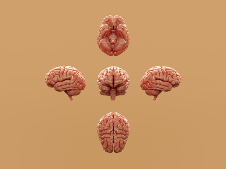 Photo brain
