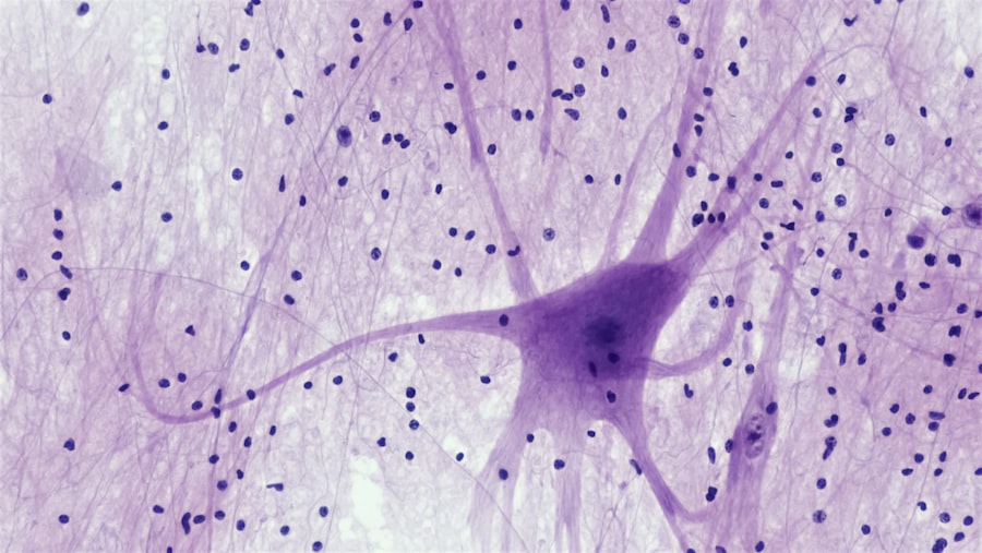 Photo neuroscience