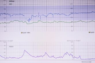 Photo power asymmetry diagnostic