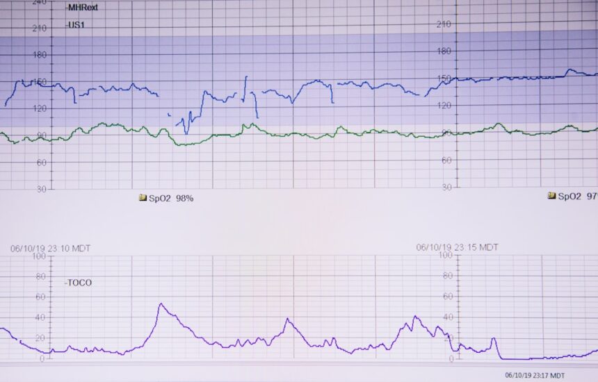 Photo power asymmetry diagnostic