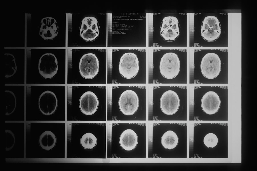 Photo brain