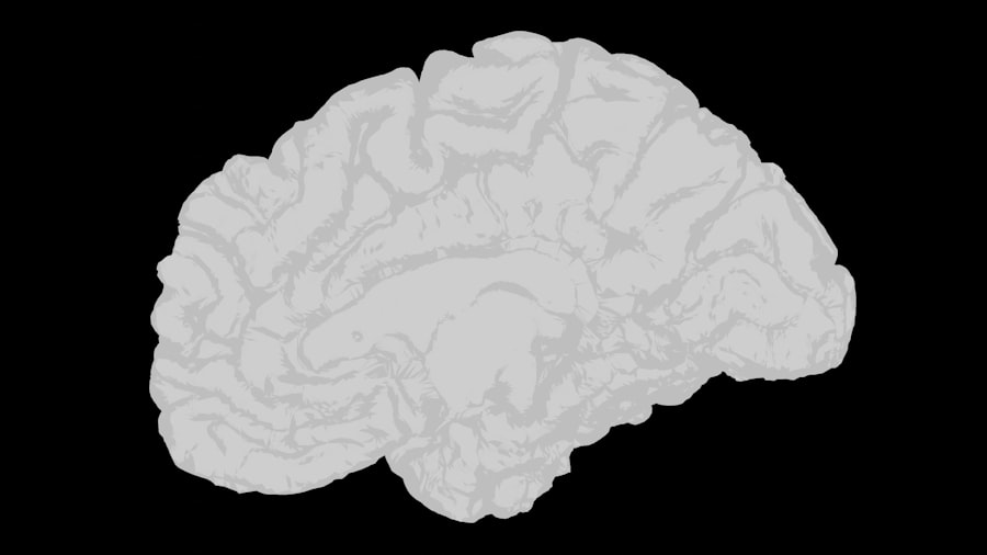 Photo brain, uncertainty, relationships