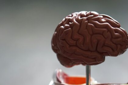 Photo brain