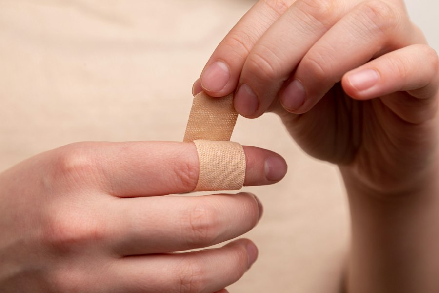 Photo attachment wounds