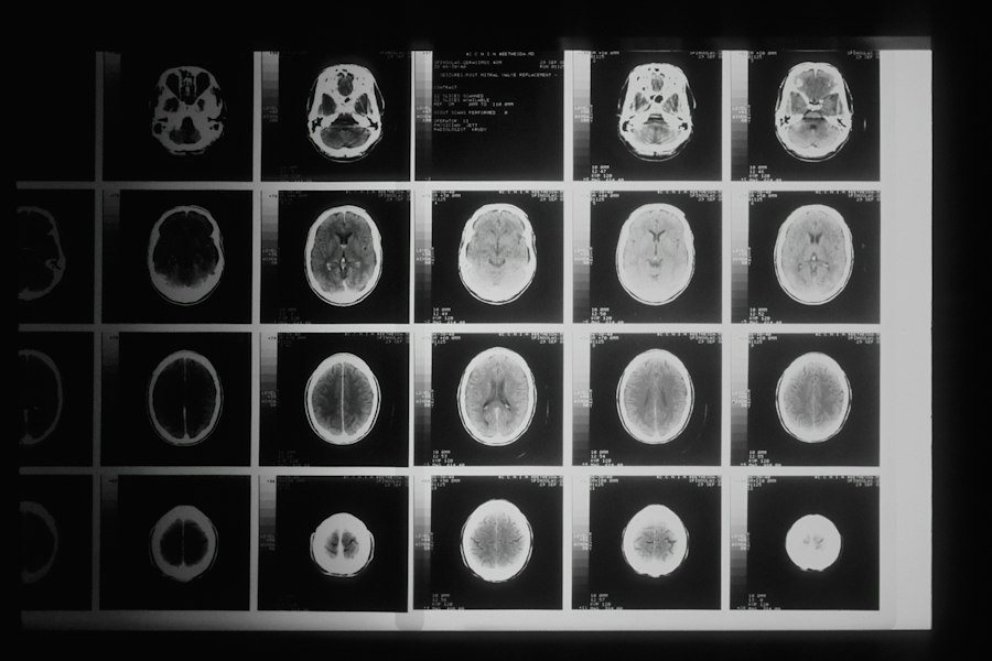 Photo famous psychology experiments