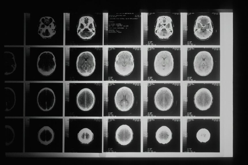 Photo Rosenhan study psychiatric diagnosis validity