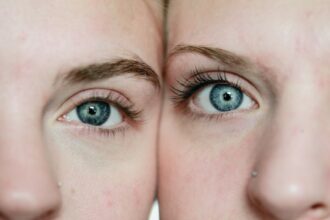 Photo identical twins schizophrenia severity differences