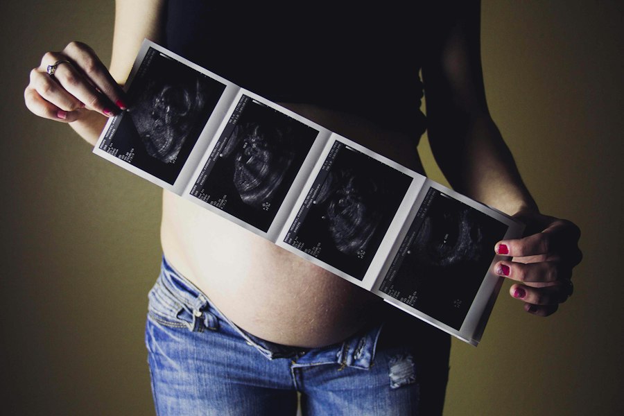 identical quadruplets mental illness study