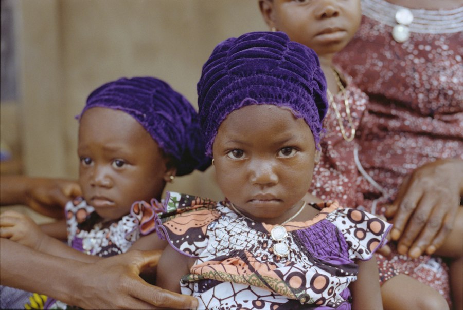 Photo schizophrenia identical quadruplets